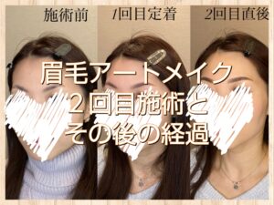 眉毛アートメイク2回目とその後の経過報告